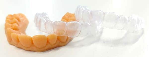 Orthodontic retainer : 14 262 images, photos de stock, objets 3D